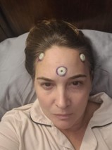 Tresa Spencer laying in a hospital bed with "fiducials," or special surgical markers, on her head to help guide brain surgeons for brain surgery.