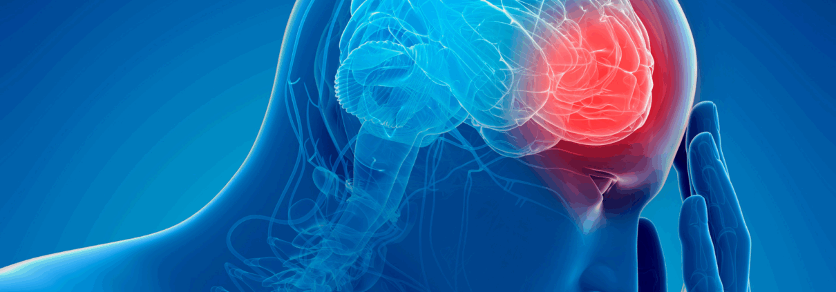 An illustration of a human head is shown in profile. Like an X-ray, we can see the spinal column and brain. Everything is in blue colors except for an area at the front of the brain that is in red. And the human his holding their hand to their head.